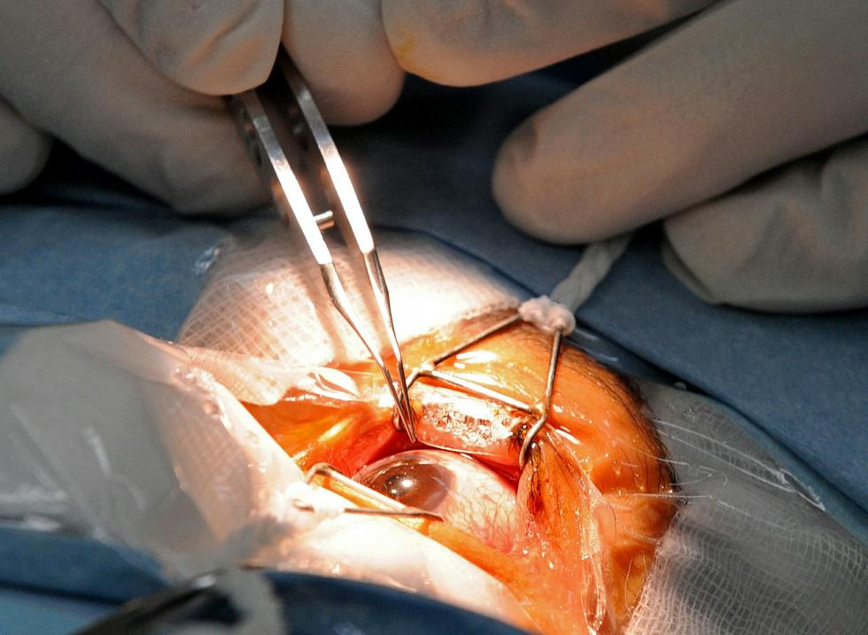 cataract-surgery.jpg
